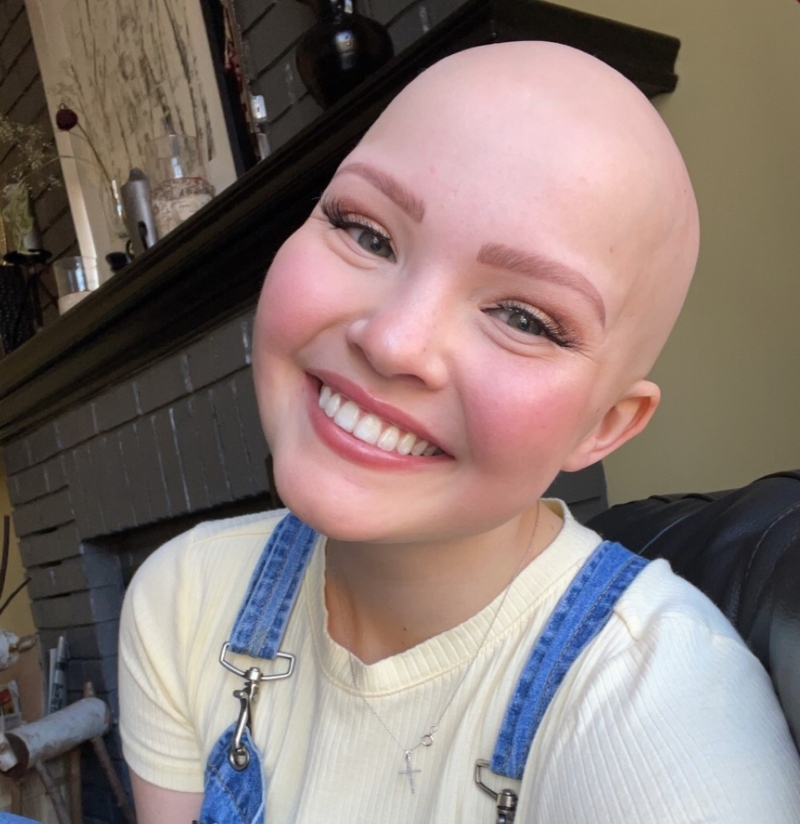 Marcy Gallant News Talk 1010 Canadian Alopecia Areata Foundation