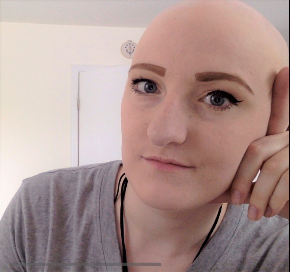 Meet Charlotte, CANAAF's Ottawa Support Group Leader