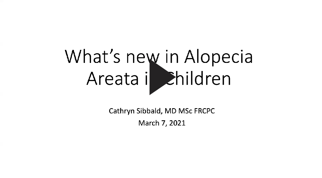 Regardez une mise à jour sur l’alopécie areata chez les enfants [An Update on Alopecia Areata in Children] pour en savoir plus sur les traitements.