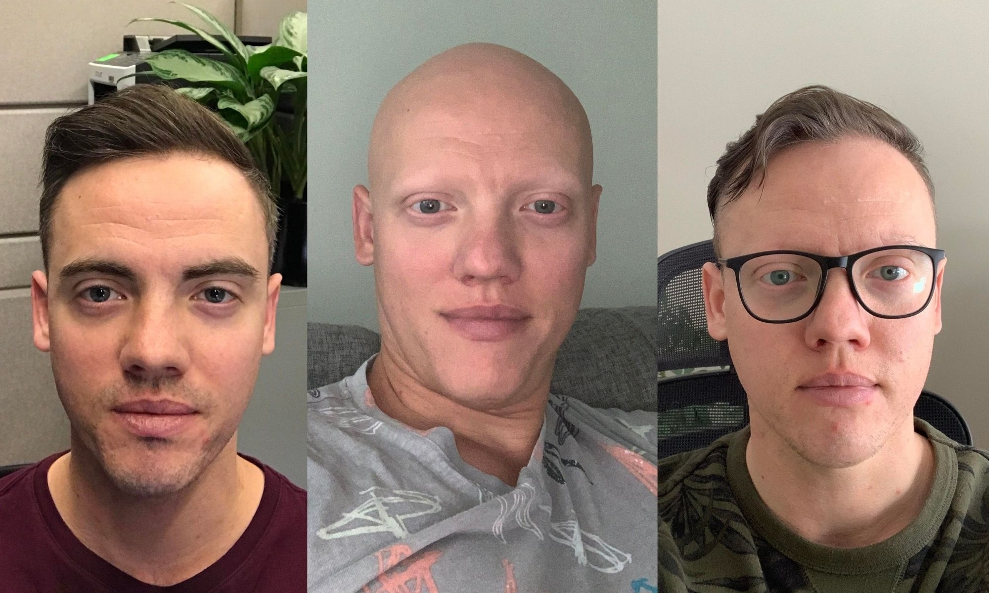 International Clinical Trials Day 2022: What it's like to be in a clinical  trial - Canadian Alopecia Areata Foundation