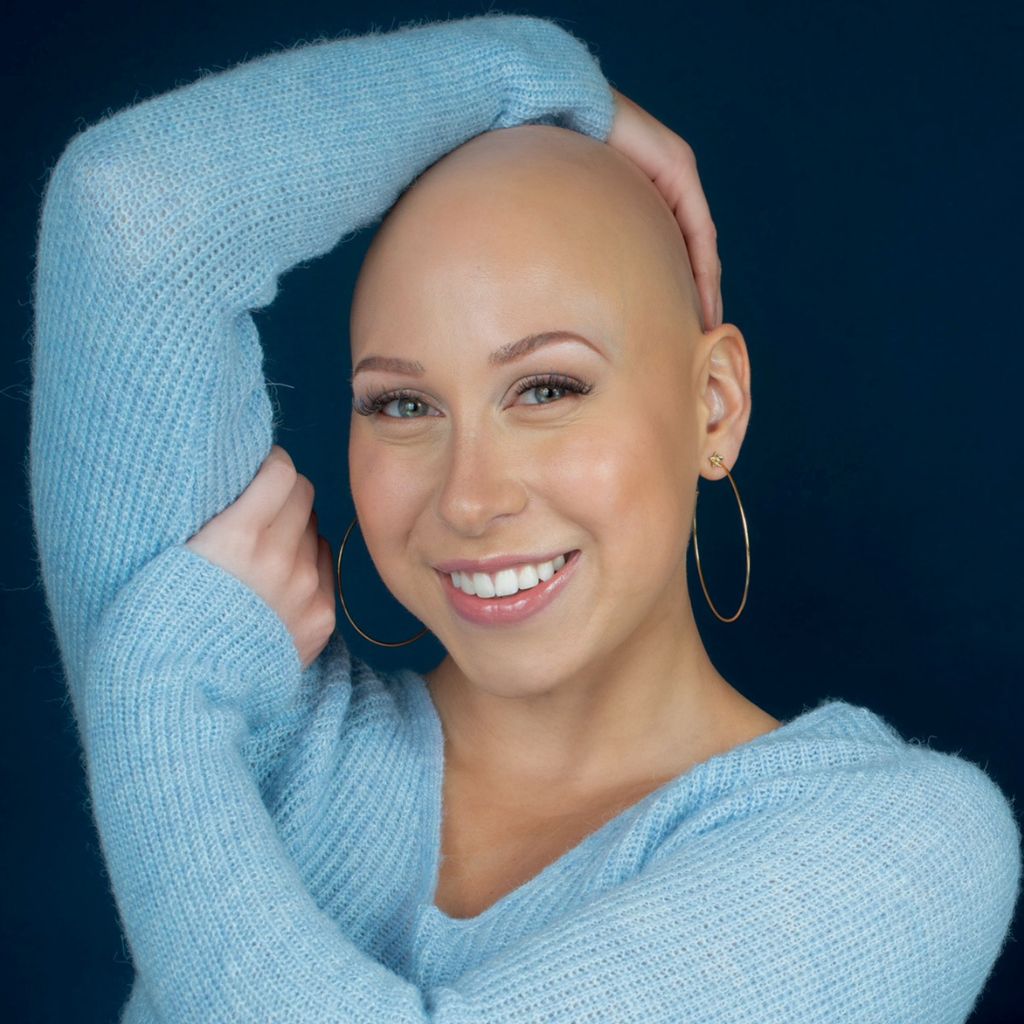 Lauryn Harrison, co-host of Alopecia's Audacity Podcast
